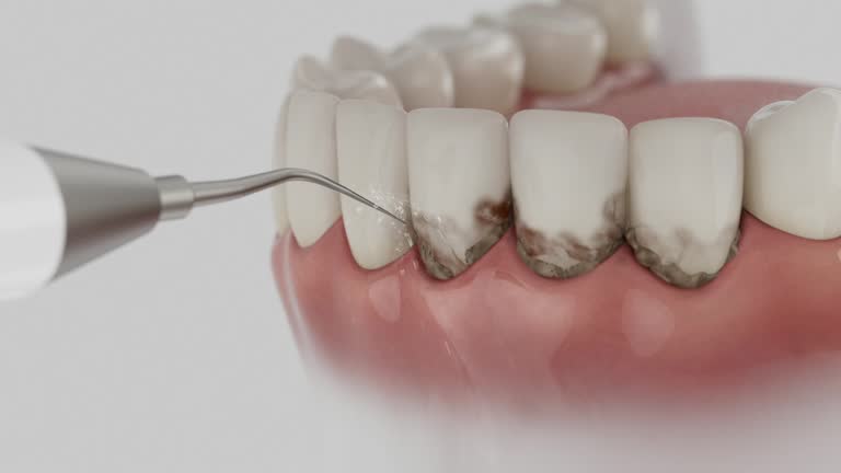 Reliable Dental Implants contractor in Spencer, NC by Smile Center Dentistry